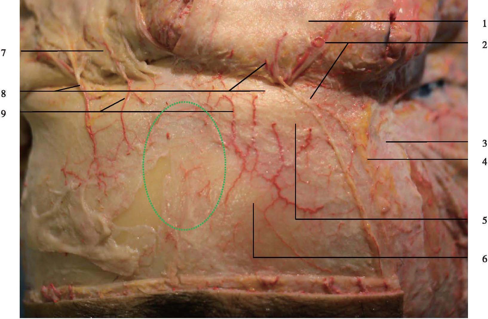 眶上神經(jīng)深支、額部安全注射區(qū)